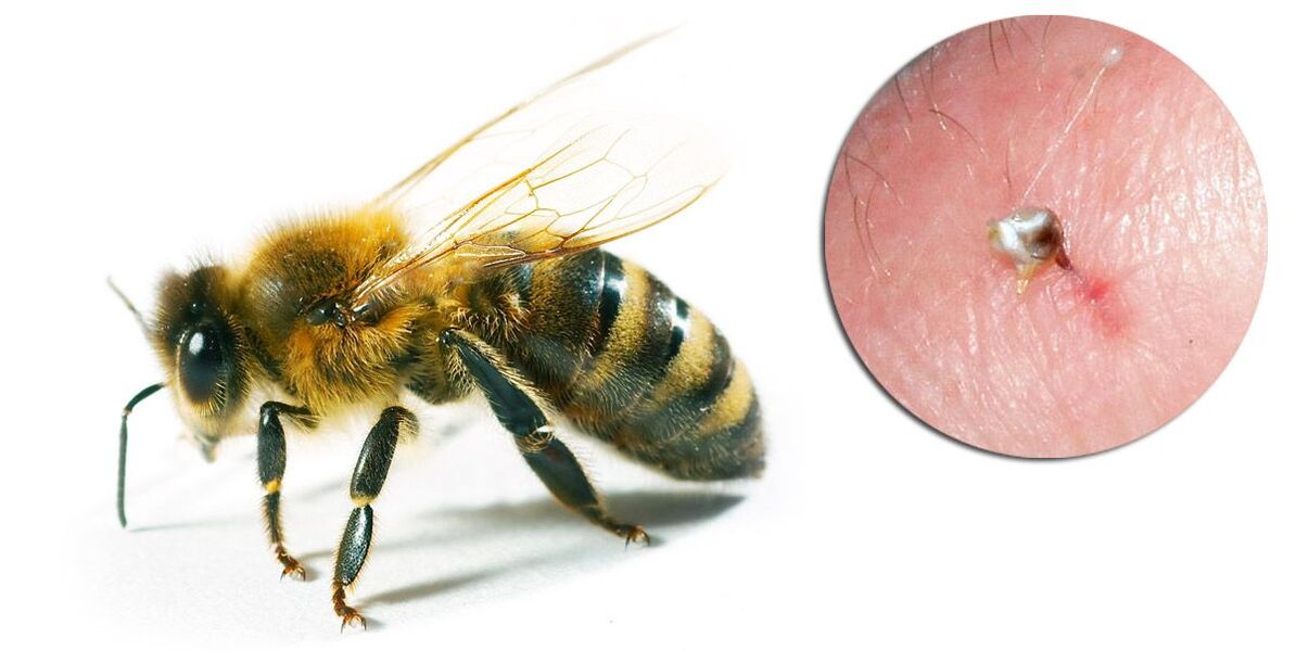 A Hondrostrong méhmérget tartalmaz, amely javítja az anyagcsere folyamatokat a szövetekben
